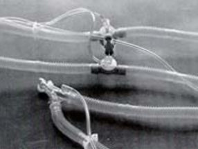 Vyaire Medical Ventilator Circuit Corrugated Tube 72 Inch Tube Dual Limb Adult - 1793