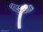 Smiths Medical Portex Flex D.I.C. Tracheostomy Tube Cannula Size 8 Uncuffed - 504080