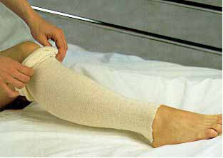 Albahealth - Stockinette Tubular 3 Inch X 25 Yard Cotton NonSterile - 81320