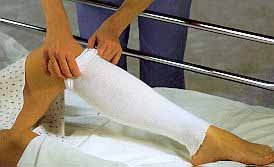 Albahealth - Stockinette Tubular 4 Inch X 25 Yard Polyester NonSterile - 86412