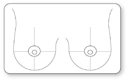 UAL - Pre-Printed Label Advisory Label White Paper Breast Black Diagram / Symbol 1-1/2 X 2-1/2 Inch - ULMC301