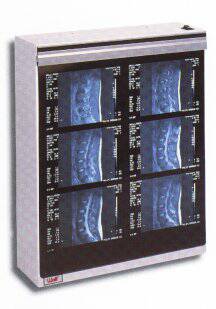 Wolf X-Ray MG-7 X-Ray Illuminator 1 Bank 1 Tier 2 Lamp 15 W Free Standing - 21104