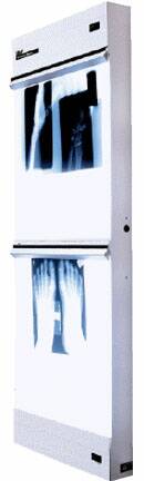 Trimline Basic - X-Ray Illuminator 1 Bank 1 Tier 2 Lamp 15 W Wall Mount 3-1/4 X 14 X 22 Inch White One, 14 X 17 Inch Film - 29501