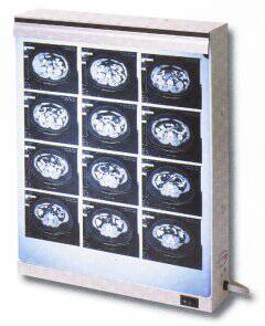 X-Ray Econoline X-Ray Illuminator