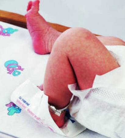 Cardinal Infant Heel* Infant Heel Warmer Instant Chemical Activation Heel 4 X 4 Inch - 11460-010T