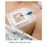 Centurion Medical Products Dressing Window Sorbaview 2000 Flm 4X16" Strl Adhs Nadhr Transparent Abs 50/Case - SV46VST