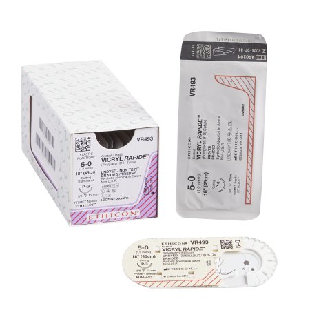 Coated Vicryl Rapide - Suture with Needle Absorbable Coated Undyed Suture Braided Polyglactin 910 Size 5 - 0 18 Inch Suture 1-Needle 13 mm Length 3/8 Circle Precision Point - Reverse Cutting Needle - VR493