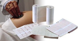 Precision Charts - Diagnostic Recording Paper Thermal Paper 120 mm X 50 Foot Z-Fold Red Grid - 781-080-12