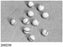 Gardlok - Surgical Cherry Dissector Sponge X-Ray Detectable Cotton / Gauze 1/4 Inch Diameter 10 Count Tray Sterile - 200230