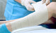 Albahealth - Bias Cut Stockinette Cotton 6 Inch X 4 Yard Natural Sterile - 8264