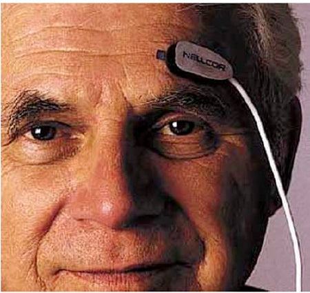 Covidien Oxisensor SpO2 Sensor Adult Forehead - RS10