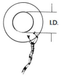 Olympus America Inc Ear Ventilation Tube Collar Button Style 1.5 mm - 145214-ENT