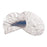 Davol Dressing Hernia Repair Composix E/X Polypropylene 6X8" 1/Ca - 123680