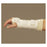 Deroyal Industries Inc Brace Fracture Adult Wrist Thermoplastic White Size Large Left Ea - FB5000-14
