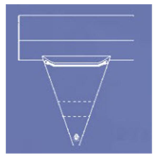 Microtek Medical Drape Underbuttocks Hysteroscopy Fenestrated 39X34" 25/Ca - 3120S