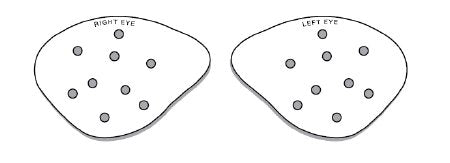BD Visitec - Eye Protector One Size Fits Most - 581019
