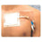 Integra LifeSciences Corp Fastener Catheter Cath-Strip 1/Pouch 50/Ca - CS50