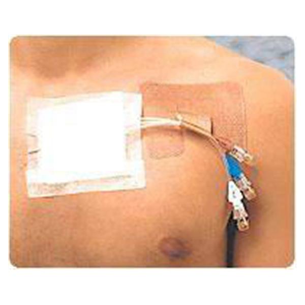 Integra LifeSciences Corp Fastener Catheter Cath-Strip 1/Pouch 50/Ca - CS50