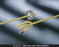 Bard Bard Lubricath Foley Catheter 3-Way Round Tip 5 cc Balloon 16 Fr. Latex - 0119L16