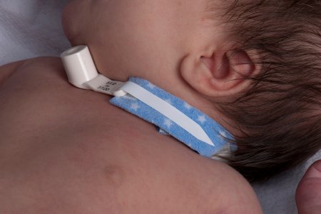 Dale Medical Products Dale Pedi Prints Tracheostomy Tube Holder - 242