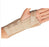 ProCare Universal - Wrist Brace Aluminum / Cotton / Elastic Left or Right Hand Beige X-Small - 79-87092