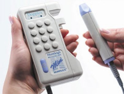 Dopplex Doppler - Handheld Doppler NO Display Vascular Probe 10 MHz - LUS-D900-P-VP10KIT