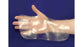 Multiform Thin - Splinting Material 1/16 X 18 X 24 Inch Elastic Transparent - 4008