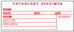Timemed - Pre-Printed Label Laboratory Use White Pathology Specimen, Name, Date, Sex, Age, Room, Doctor, Speciment, Number Red Lab / Specimen 2 X 3-1/2 Inch - SP-5