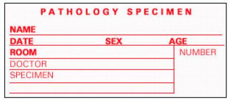 Precision Dynamics TimeMed Pre-Printed Label Timemed Laboratory Use Pathology Specimen, Name, Date, Sex, Age, Room, Doctor, Speciment, Number White 2 X 3-1/2 Inch - SP-5