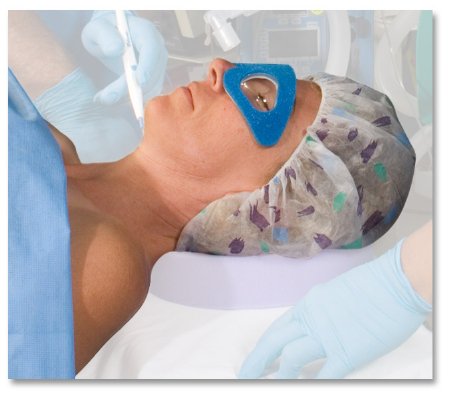 Dupaco Opti-Gard Eye Protector Small Self-adhering - 28200