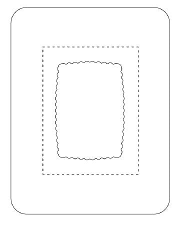 SorbaView 2000 - Transparent Film Dressing with Pad Rectangle 5 X 6-1/2 Inch Frame Style Delivery Without Label Sterile - Medline - SV80XT
