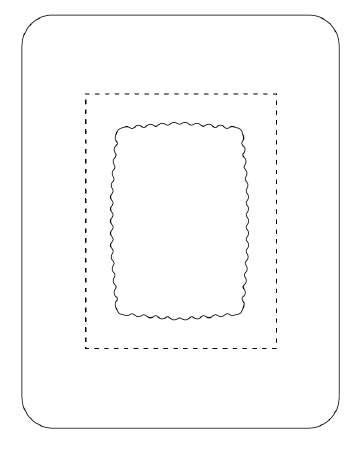 SorbaView 2000 - Transparent Film Dressing with Pad Rectangle 5 X 6-1/2 Inch Frame Style Delivery Without Label Sterile - SV80XT