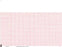 Burdick - Diagnostic Recording Paper Thermal Paper 216 X 280 mm Z-Fold Red Grid - 4758960