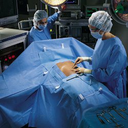 O&M Halyard - Abdominal Drape Laparoscopic / Abdominal Drape 100 W X 76 W X 124 L Inch Sterile - 89233