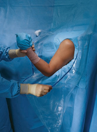 O&M Halyard - Orthopedic Drape Shoulder Arthroscopy Drape 160 W X 102 L Inch Sterile - 89070