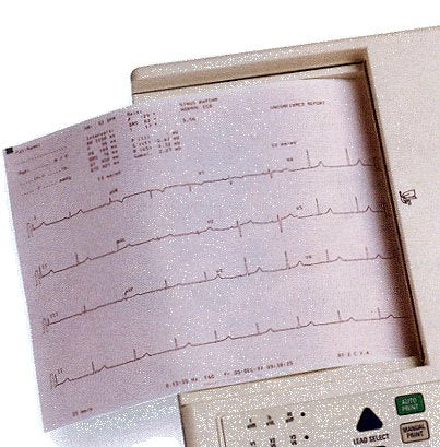 Welch Allyn ECG / EEG Recording Paper Thermal 8-1/2 X 11 Inch Fan-Fold Red Grid - 716-0237-00