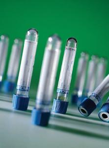 Sodium Citrate Coagulation Tubes
