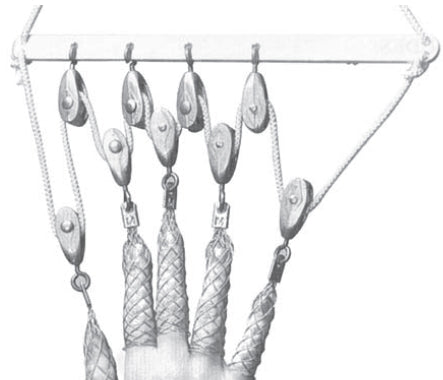 Zimmer Finger Traction Kit 5 Finger Traps, Stainless Steel Mesh, Pulleys, Suspension Bar - 32500000