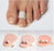 Pedifix Pedifix Toe Regulator One Size Fits Most Slip-On Left Foot - 8158-L