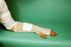 Tubular Elastic Retainer Dressing