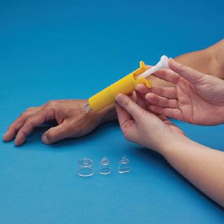 Patterson Medical Supply Rolyan Scar Pump Contains Syringe, Yellow Preston - A8391