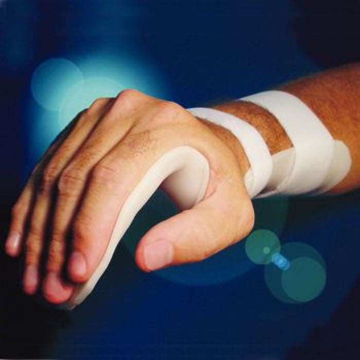 Splinting Material