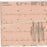 S & W Healthcare Medi-Trace ECG Recording Chart Paper Thermal 216 X 280 mm Fan-Fold Red Grid - 18416-002