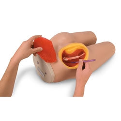 Nasco Life/Form Intramuscular Injection Simulator Teaching Guide, Supply of Syringes, and Hard Carrying Case - LF00961