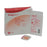 PolyMem - Foam Dressing 2 X 2 Inch Square Adhesive with Border Sterile - 203