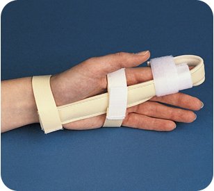 Bird & Cronin - Finger Splint Medium Left or Right Hand - 08146303