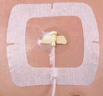 SecureView - Port Window Dressing Film 5-1/2 X 6-1/2 Inch Sterile - SCP66VXT