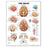 Patterson Medical Supply - Anatomical Chart Hip and Knee 20 X 26 Inch Plastic Laminated - 816907