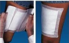 Stradis Medical Professional Adhesive Dressing 6 X 6 Inch Gauze Square White Sterile - 816-656N