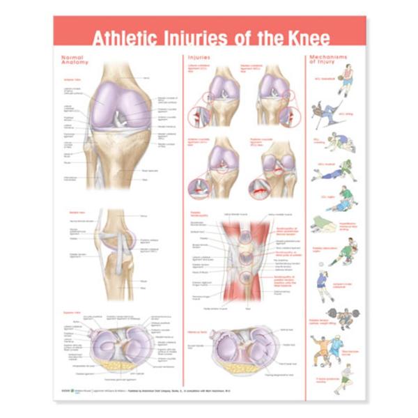 Wolters Kluwer Health Inc Chart Educational Knee Injuries 20X26" Ea - 978078178675